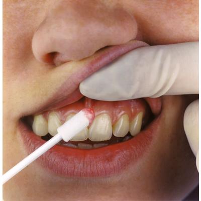 Quick Swab Foam Applicator – 3