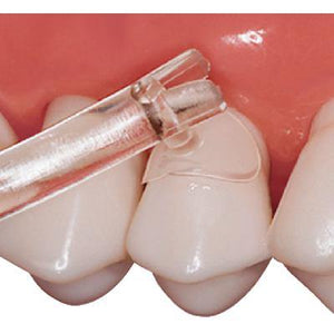 Cure-Thru® Clear Cervical Matrices