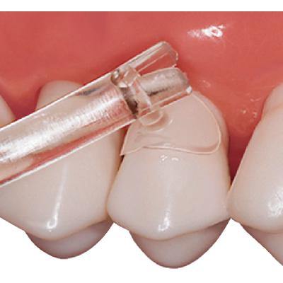 Cure-Thru® Clear Cervical Matrices