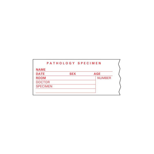 Lab Communication Tape, Removable, Pathology Specimen, W1-1/2