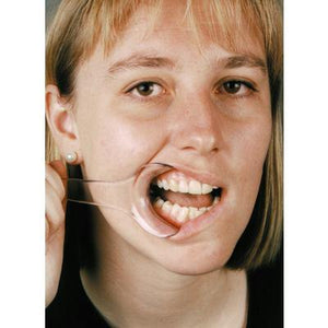 Lip/Cheek Retractors – Mirahold Cheek Retractor, 2/Pkg