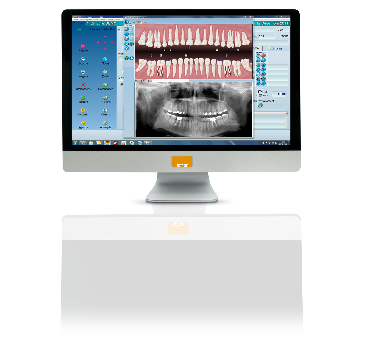 Cephalometric analysis and tracing module using A.I. (artificial intelligence)