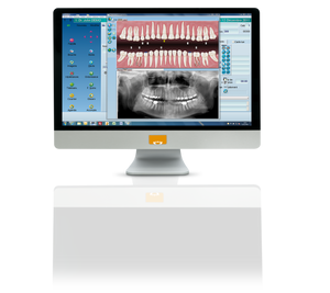 Cephalometric analysis and tracing module using A.I. (artificial intelligence)