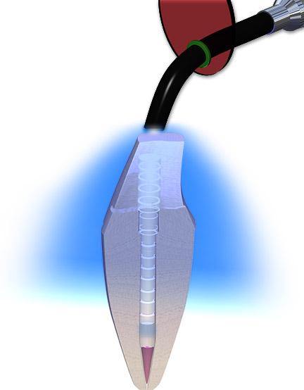 EZ-Fit Translucent